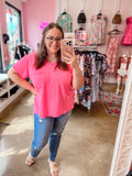 Neon Pink Burnout Top